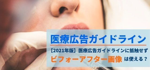 医療広告ガイドラインに抵触せず施術のビフォーアフター画像を…