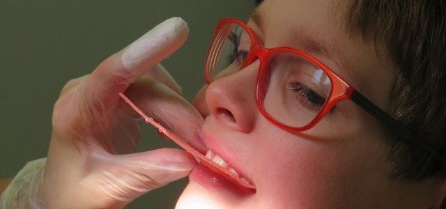 歯の治療を受けている子供のイメージ画像